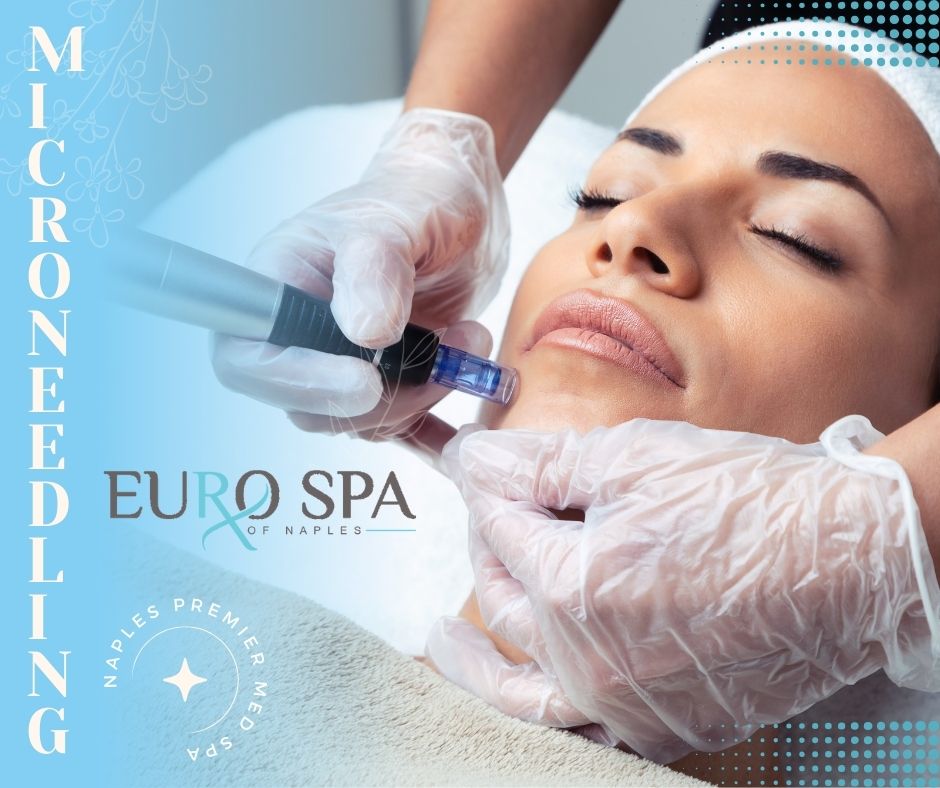 Microneedling at Euro Spa of Naples