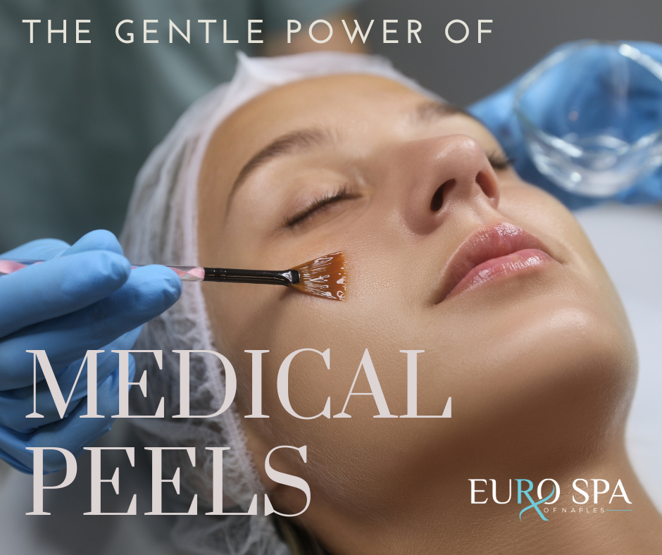 Medical-grade Peels at Euro Spa of Naples